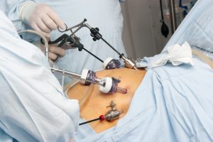 Gastric Bypass & ERCP